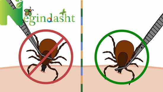 the-correct-way-to-remove-the-tick-from-the-skin