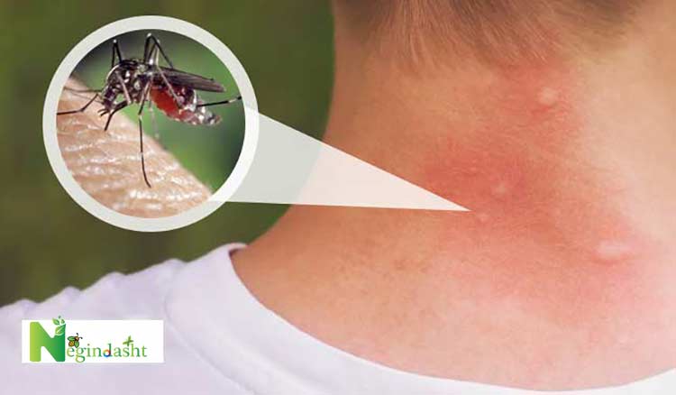 Photo of Aedes mosquito bite